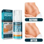 Jaysuing Advanced Scar Gel 50ml